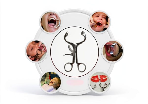 Molt Mouth Gag Stainless Steel Dental Gag by Precise Canada-1